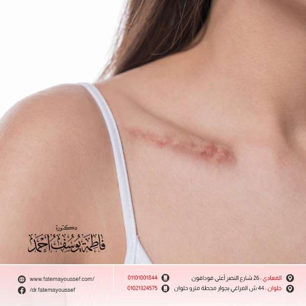 سعر عملية تجميل الجروح