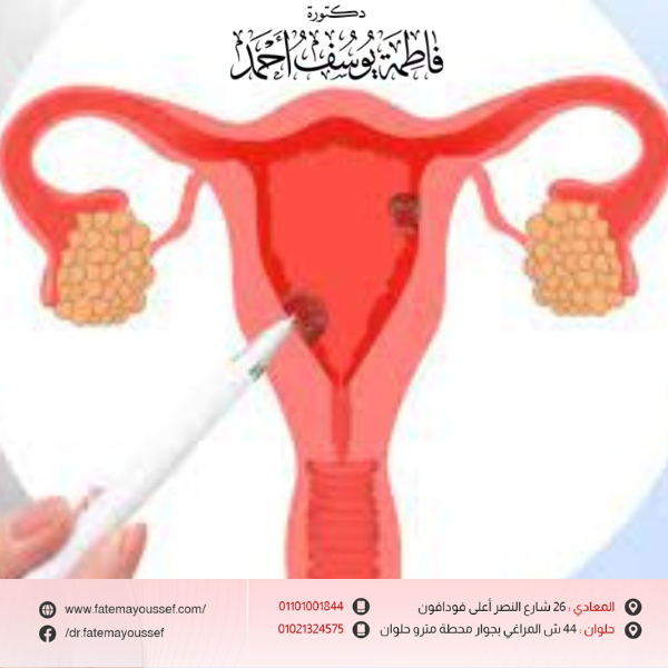 أشكال الزوائد الجلدية في المهبل