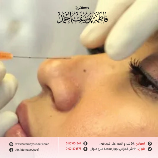 أضرار الفيلر مستقبلًا