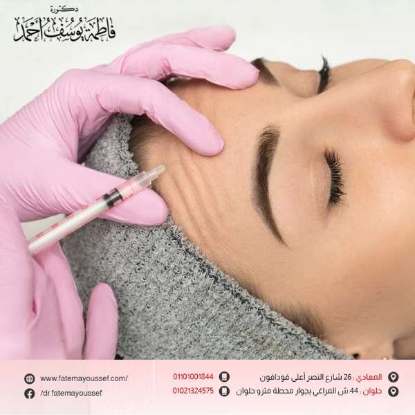 بوتكس الوجه قبل وبعد