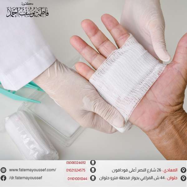 افضل دكتور جراحة اليد في مصر