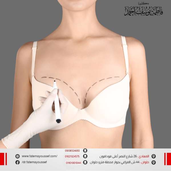 تكلفة عملية رفع الثدي في مصر