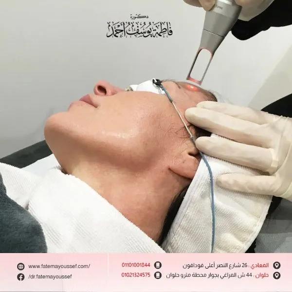 جلسة فراكشنال ليزر للوجه