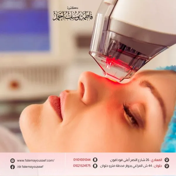 جلسة فراكشنال ليزر للوجه