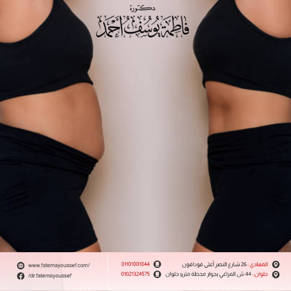 شفط الدهون من البطن بدون جراحة