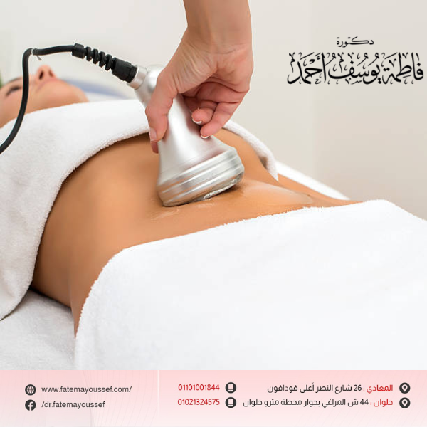 شفط الدهون من البطن بدون جراحة