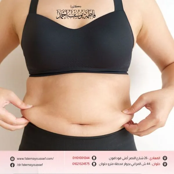 طريقة سحرية للتخلص من ترهلات البطن