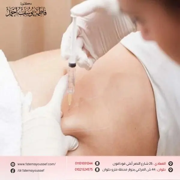 متى تظهر نتيجة حقن الميزوثيرابي للتخسيس