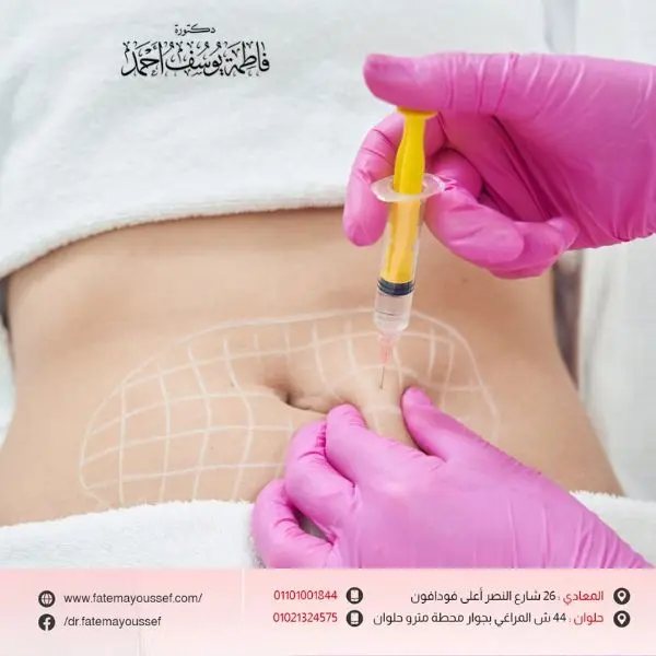 متى تظهر نتيجة حقن الميزوثيرابي للتخسيس