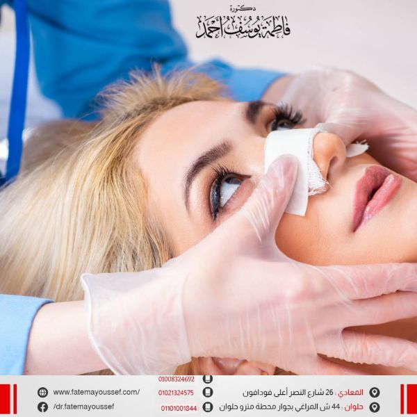 افضل دكتور تجميل انف في مصر