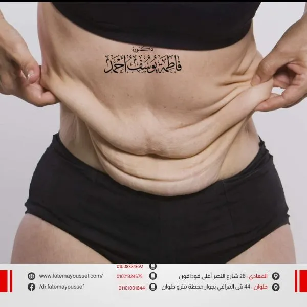 تخسيس البطن والصدر للنساء