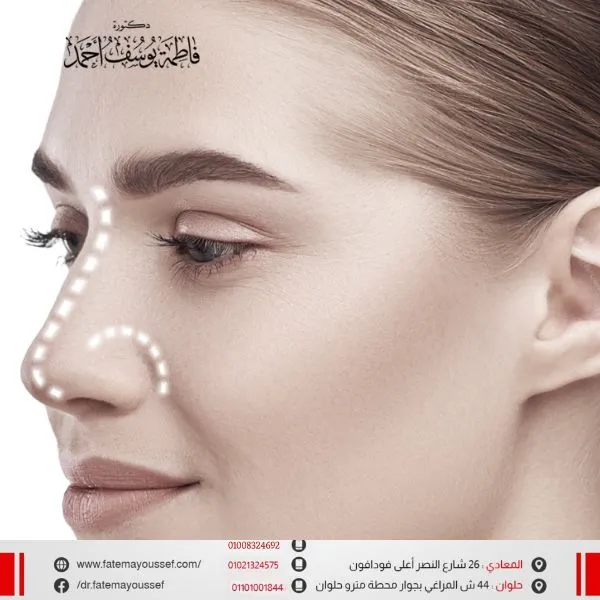 تكلفة عملية تجميل الانف في مصر