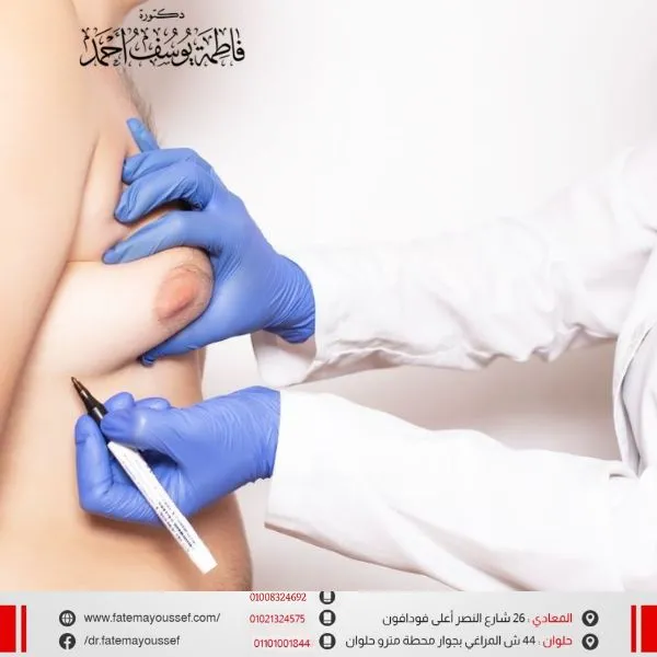 عملية التثدي عند الرجال بالليزر