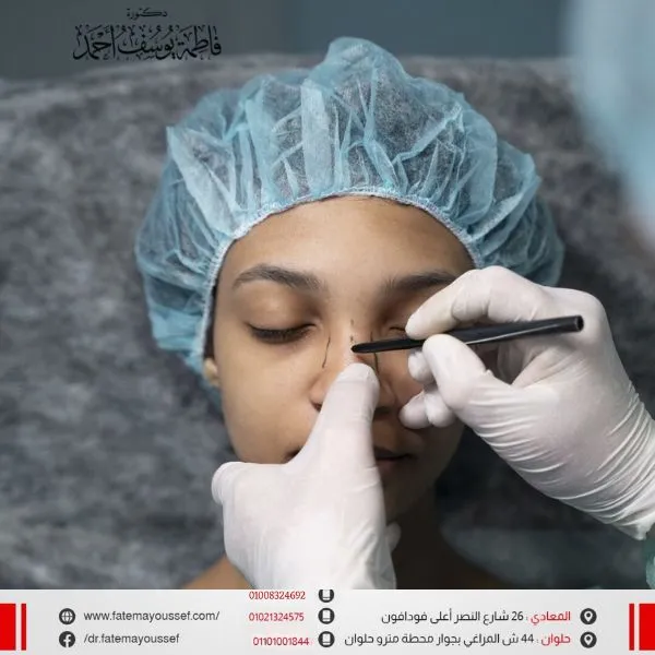 عملية تعديل الحاجز الأنفي بالليزر