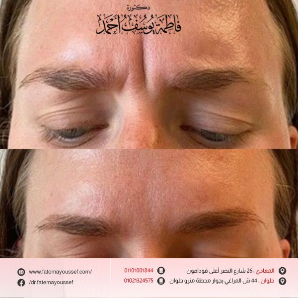 عمليات تجميل الوجه بالصور