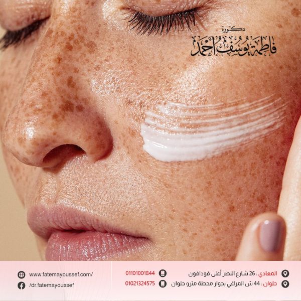 أسباب التصبغات في الوجه