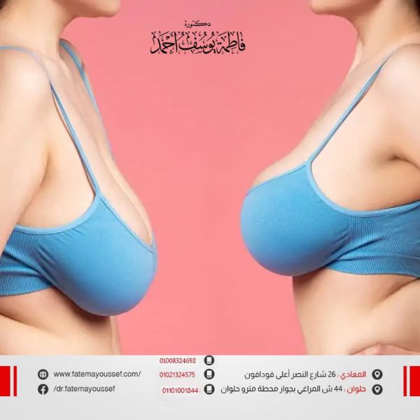 أسباب ترهل الثدي في سن صغير