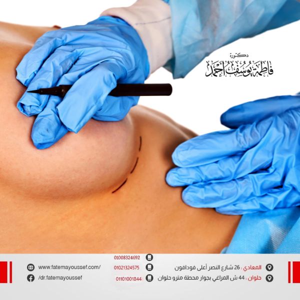 أسباب زيادة حجم الثدي الأيسر