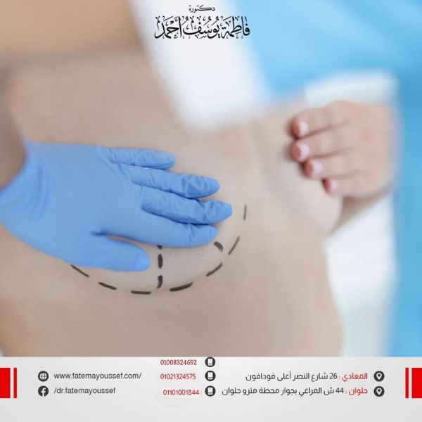 أسباب زيادة حجم الثدي الأيسر