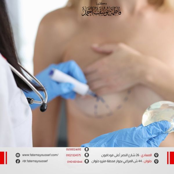 تجاربكم في تصغير الثدي