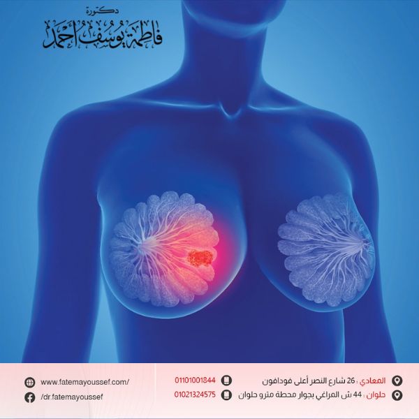 تجاربكم في تصغير الثدي