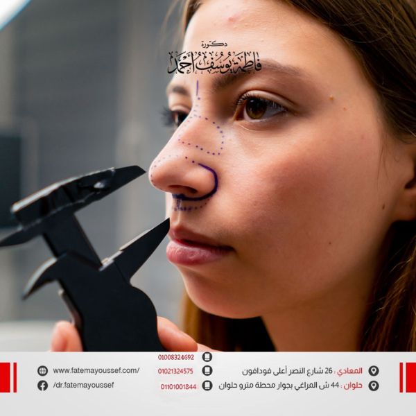 تصغير الأنف بدون جراحة