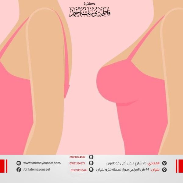 سعر عملية تصغير الثدي