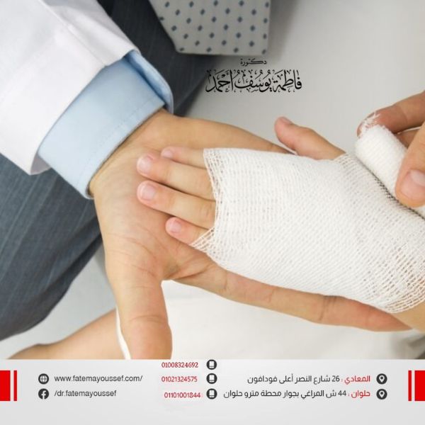 علاج حروق الماء الساخن