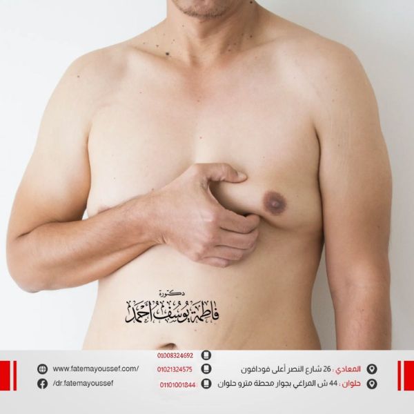 عمليات التثدي للرجال