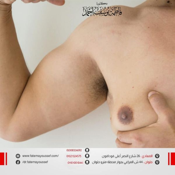 عمليات التثدي للرجال