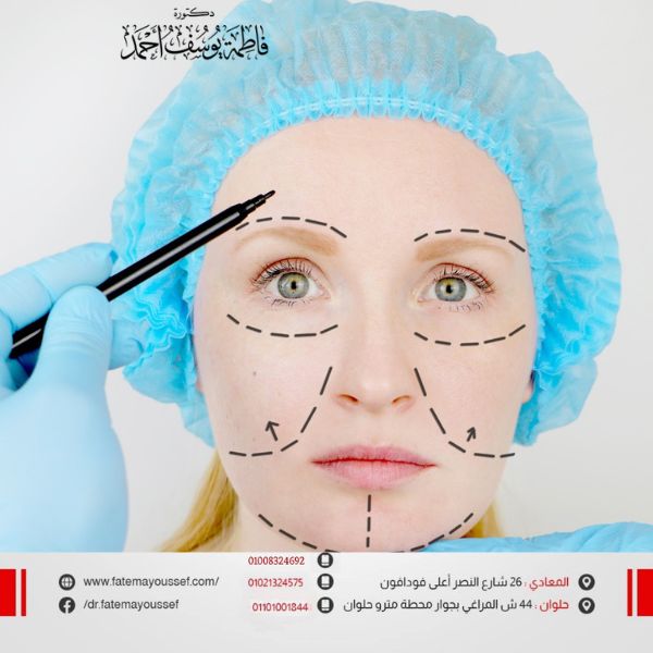 عمليات تجميل الوجه بالصور