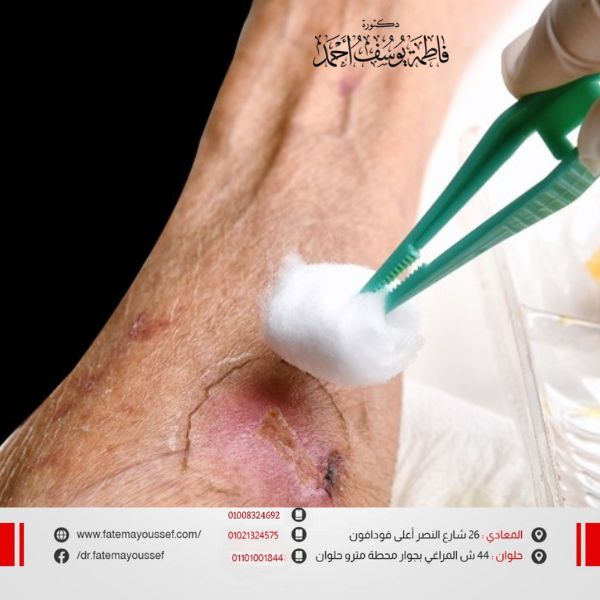قرح الفراش وتسمم الدم
