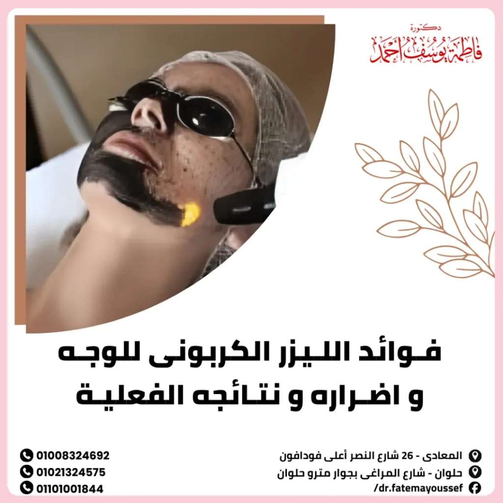 فوائد الليزر الكربوني للوجه وأضراره