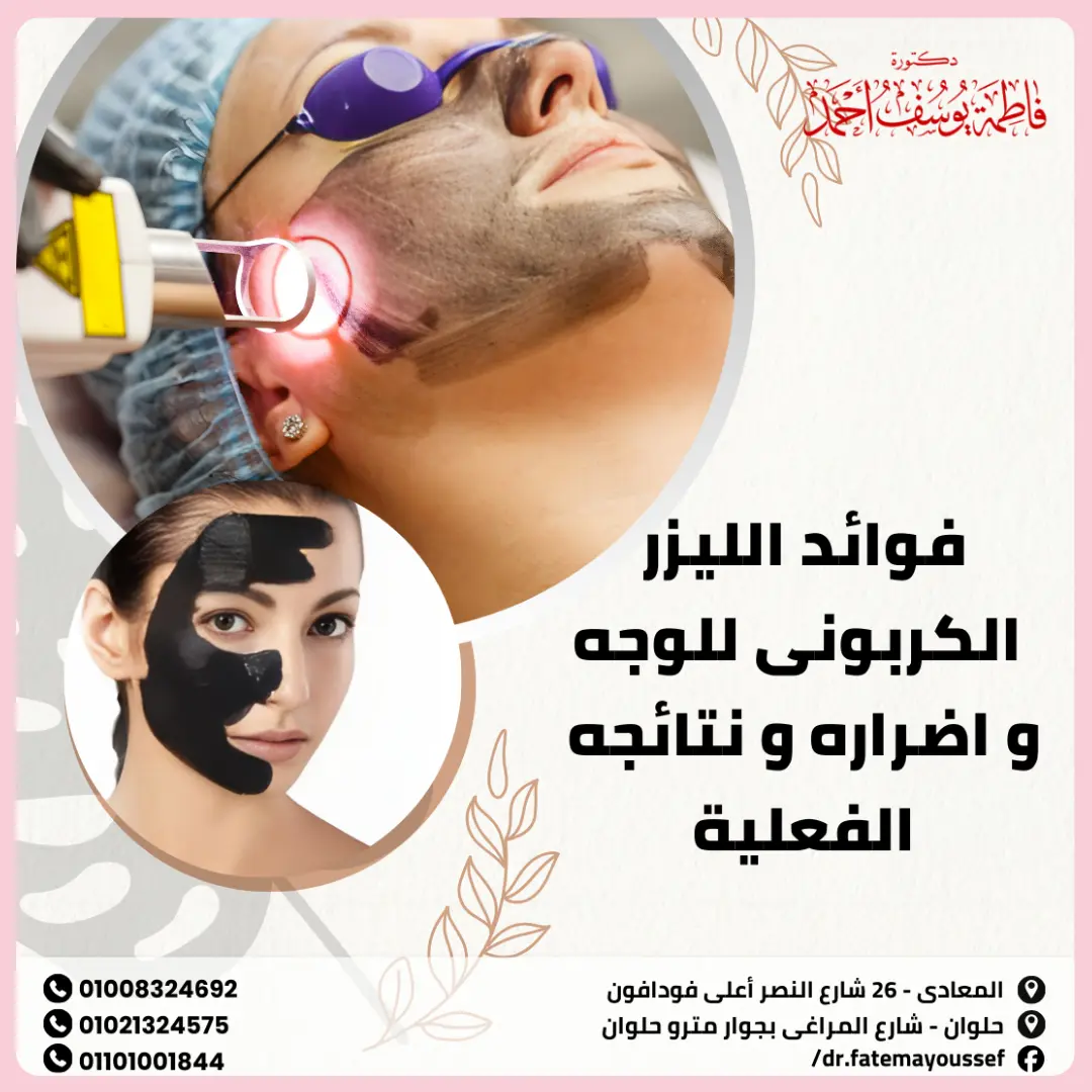 فوائد الليزر الكربوني للوجه وأضراره