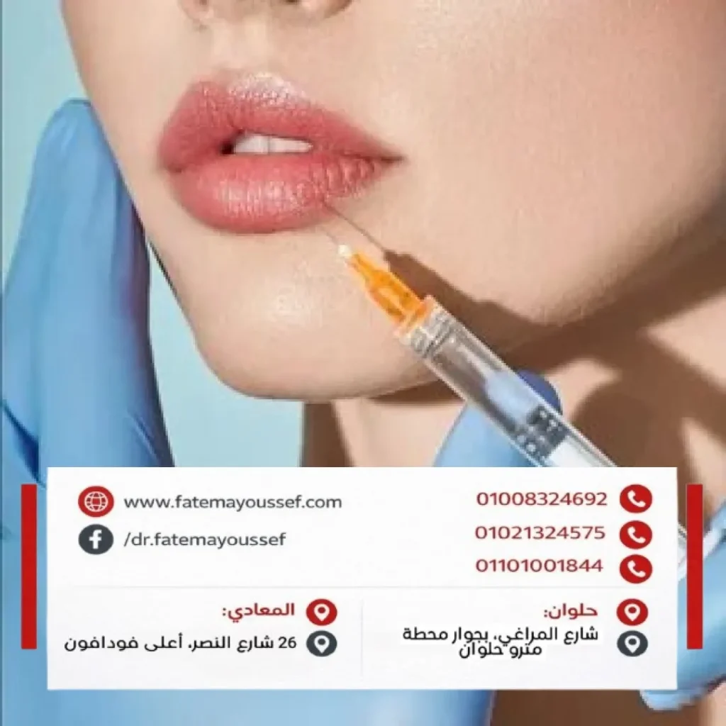 نفخ الشفايف بالفيلر قبل وبعد