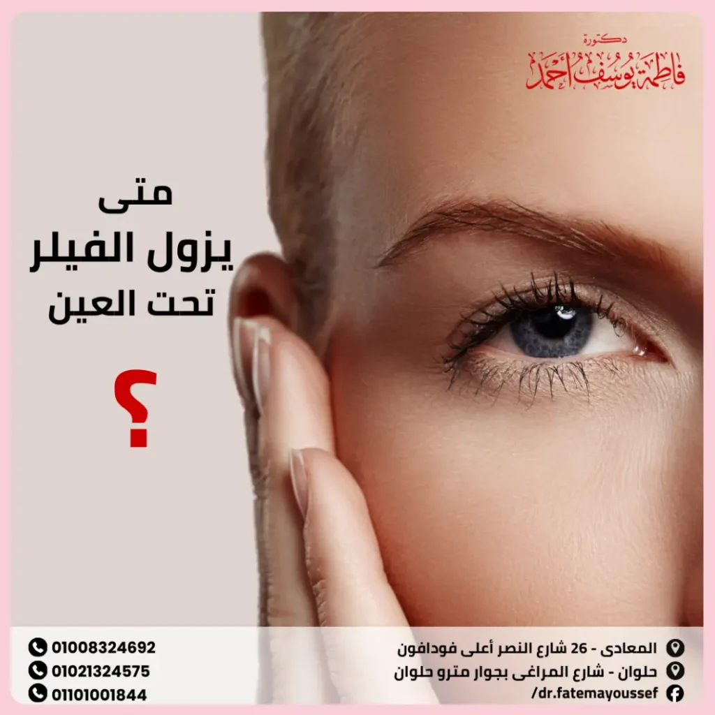 متى يزول الفيلر تحت العين