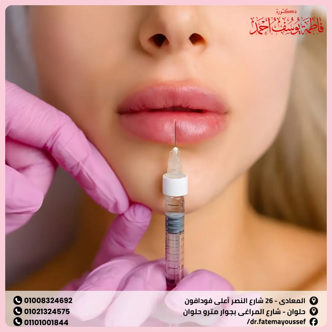 سعر ابر تذويب الفيلر