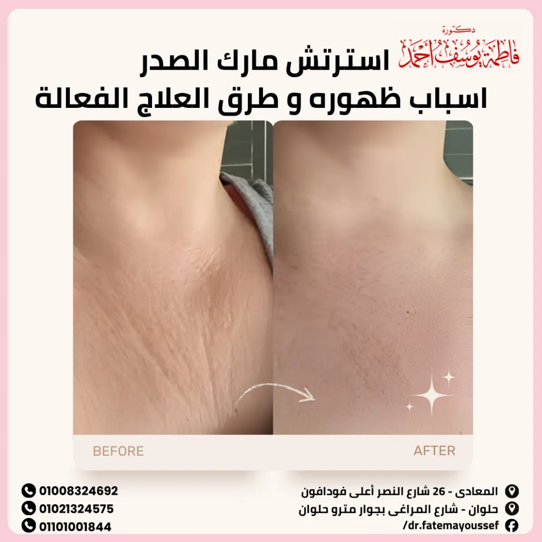 سترتش مارك الصدر