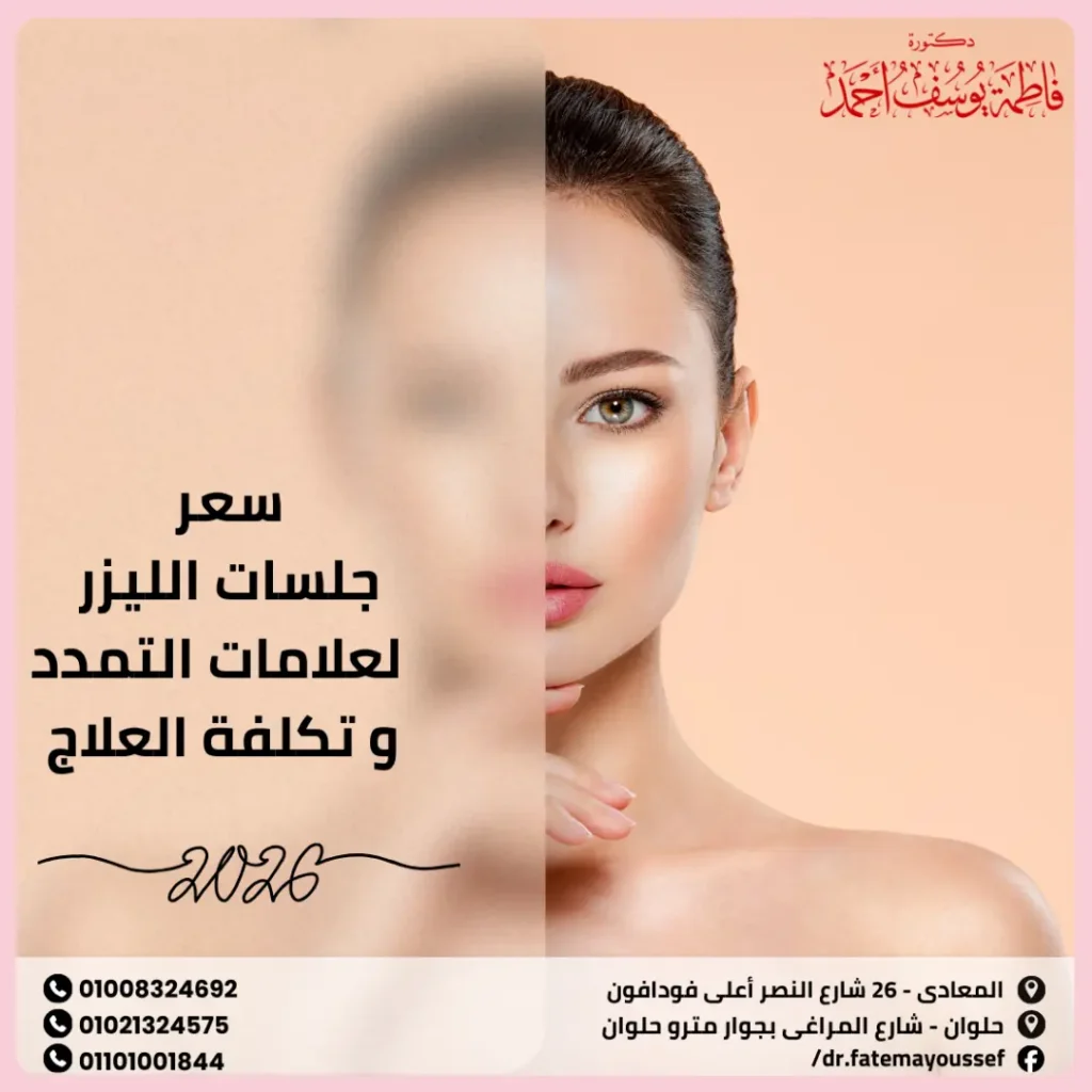 سعر جلسات الليزر لعلامات التمدد